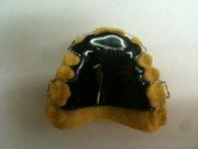 A close up of a dental appliance on a white surface.