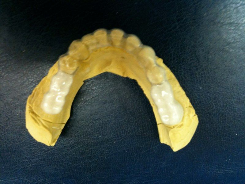 A model of a person 's teeth on a blue surface