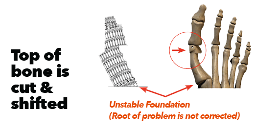 Top of the Bone is Cut & Shifted