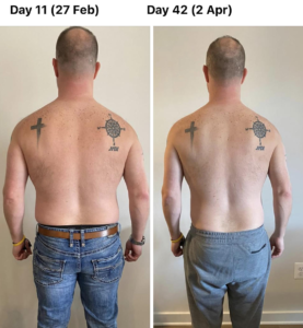 A picture of a man 's back from day 11 and day 42