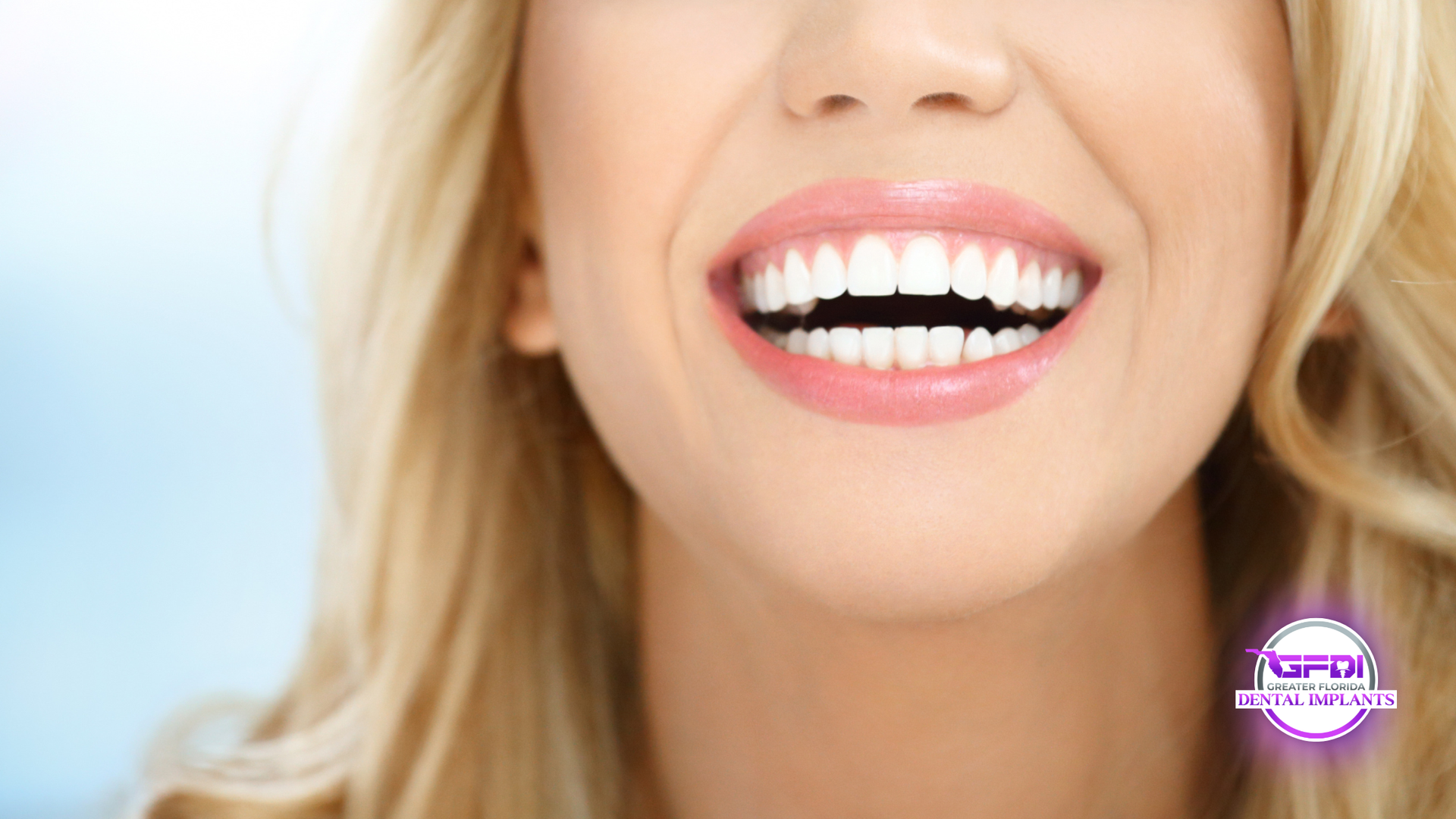 Woman with blonde hair smiling, showing perfect white teeth against a blurred blue background.