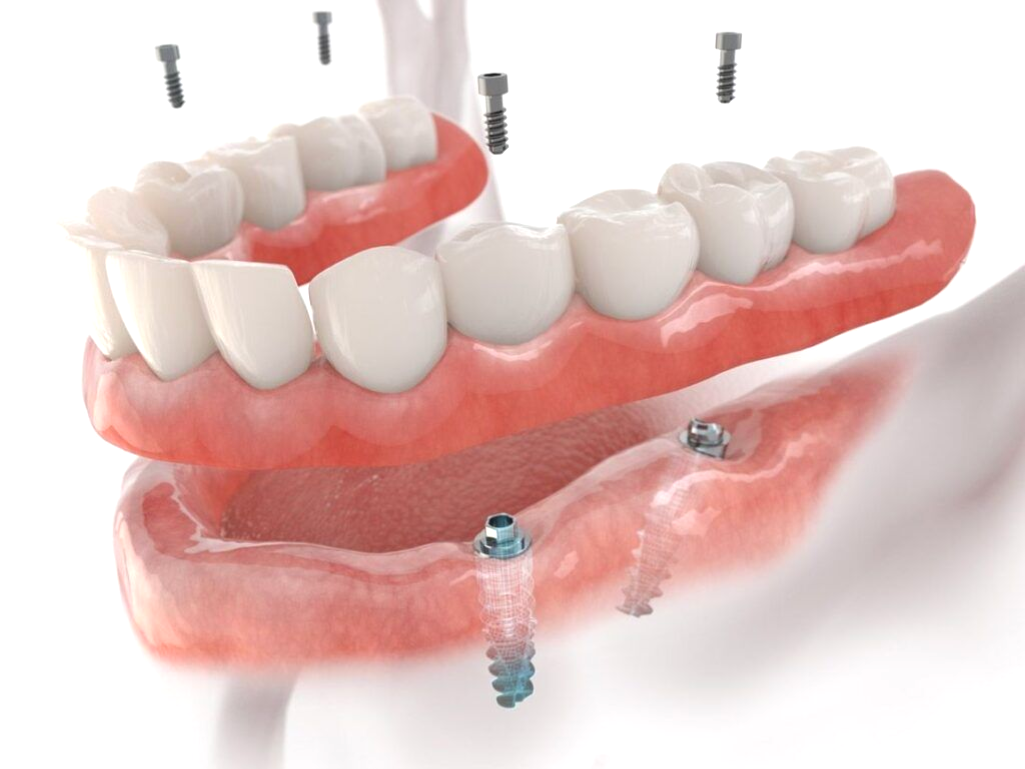 A dentist is examining a model of teeth on a table.