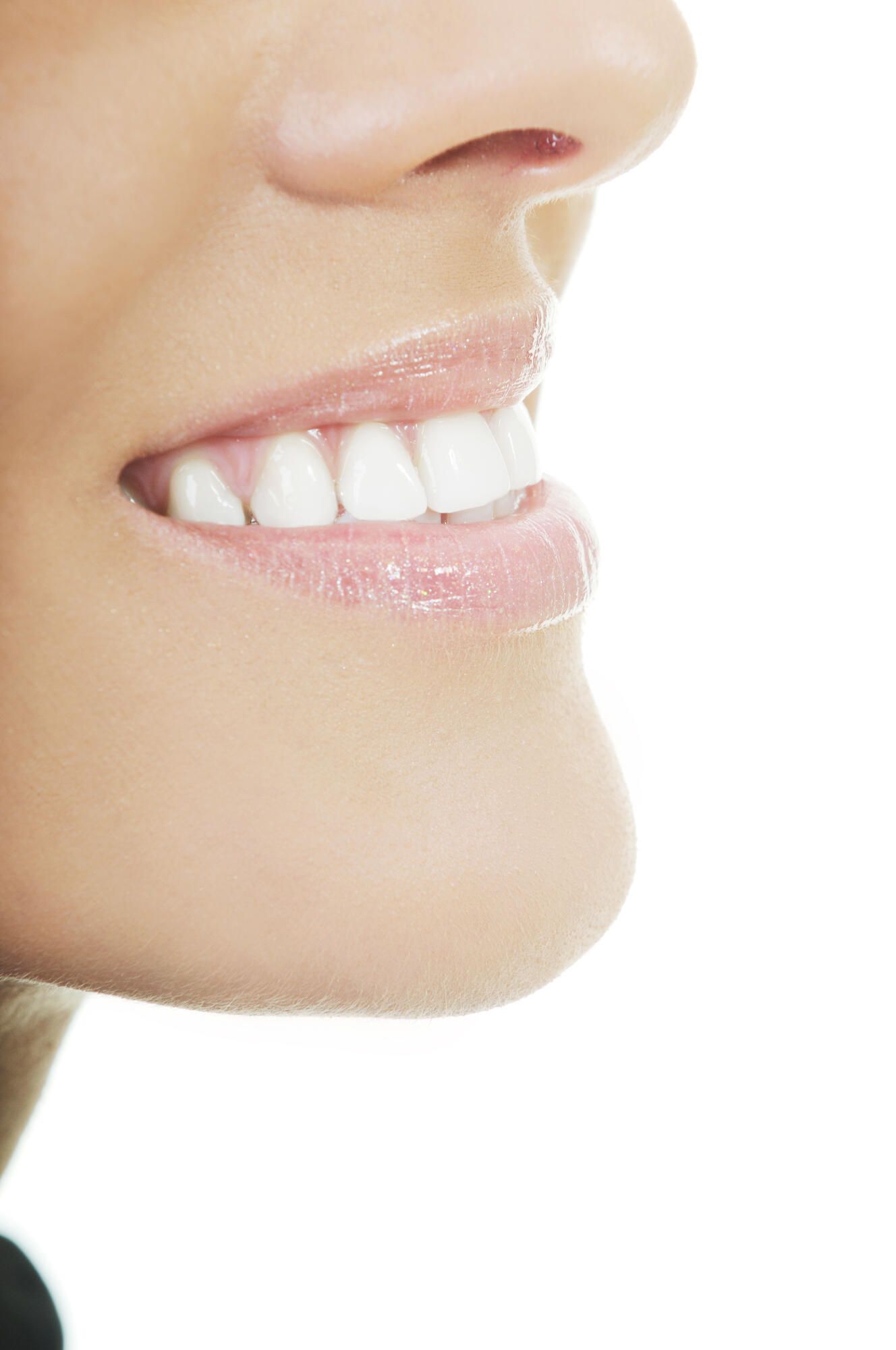 A close up of a woman 's smile with white teeth.