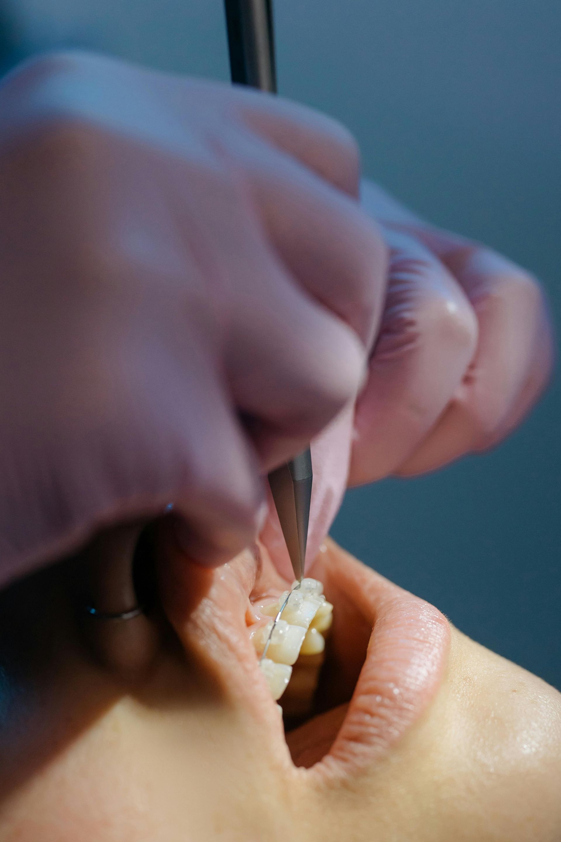 A person is getting their teeth examined by a dentist.