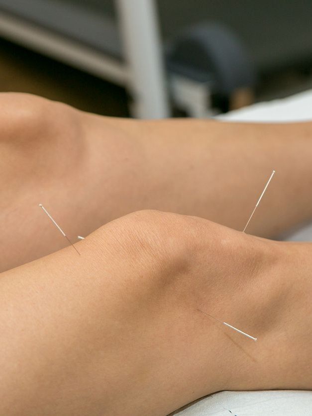 Acupuncture on the knee Acupuncture on the knee