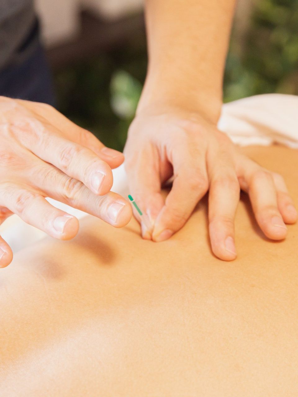 Male Acupuncturist Male Acupuncturist