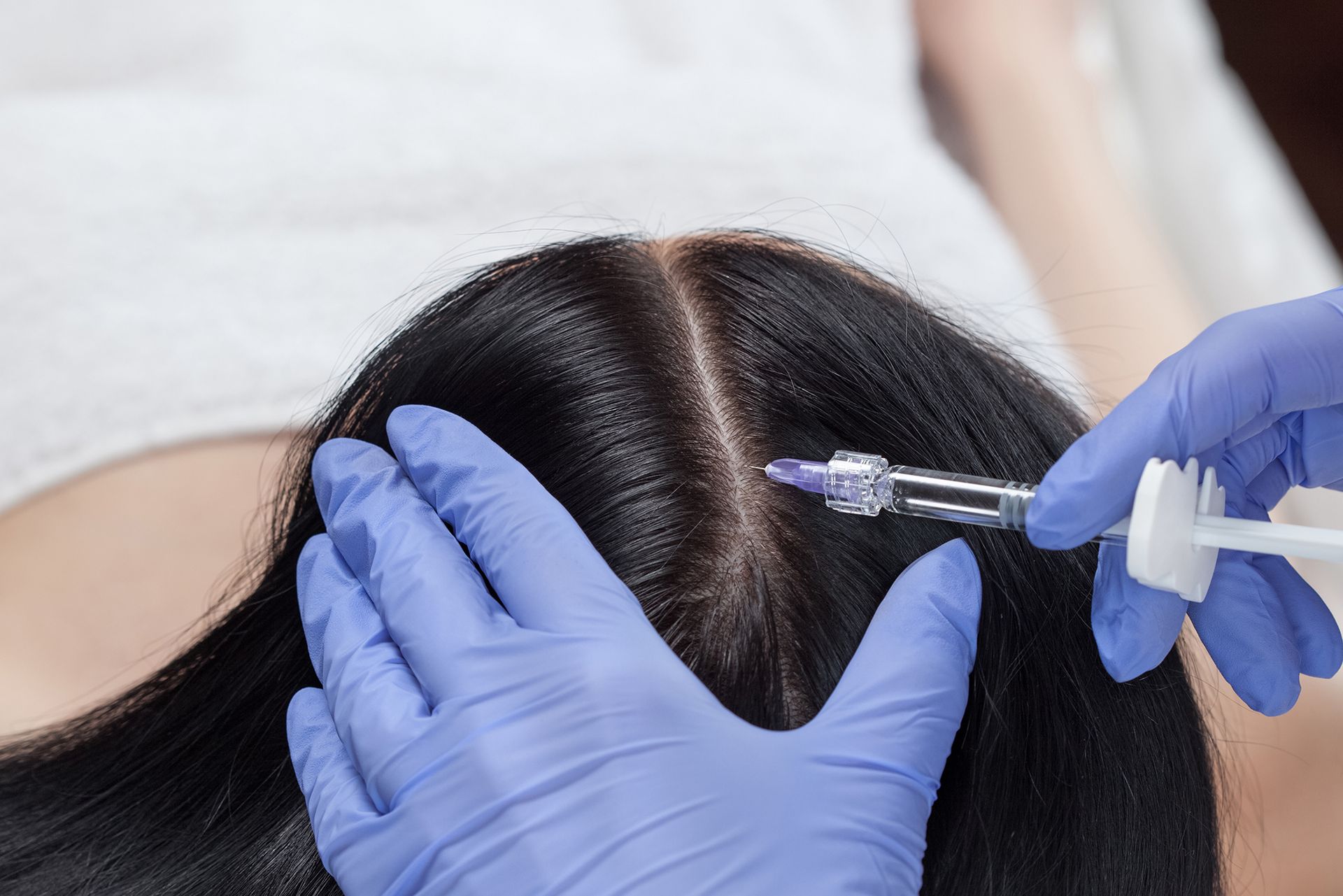 filler capelli