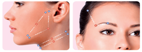 linee viso per lifting
