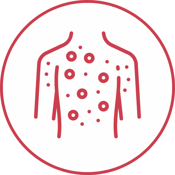 Check Up Allergie Alimentari