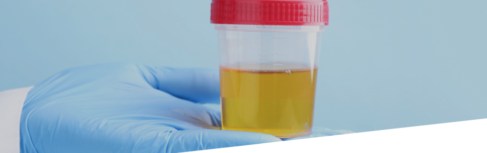 Esami urine a Verona anche senza ricetta