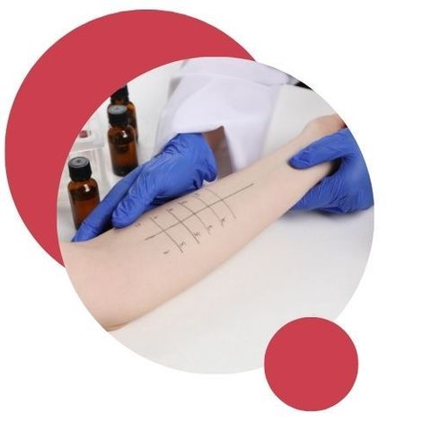 Visita allergologica e patch test Villafranca di Verona Dott.ssa Gueli