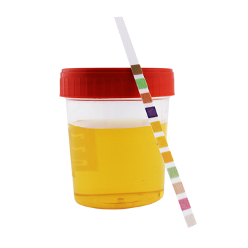 Esami urine senza ricetta verona