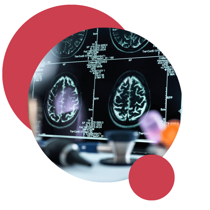 Visita Neurologica Villafranca Dott. Perini