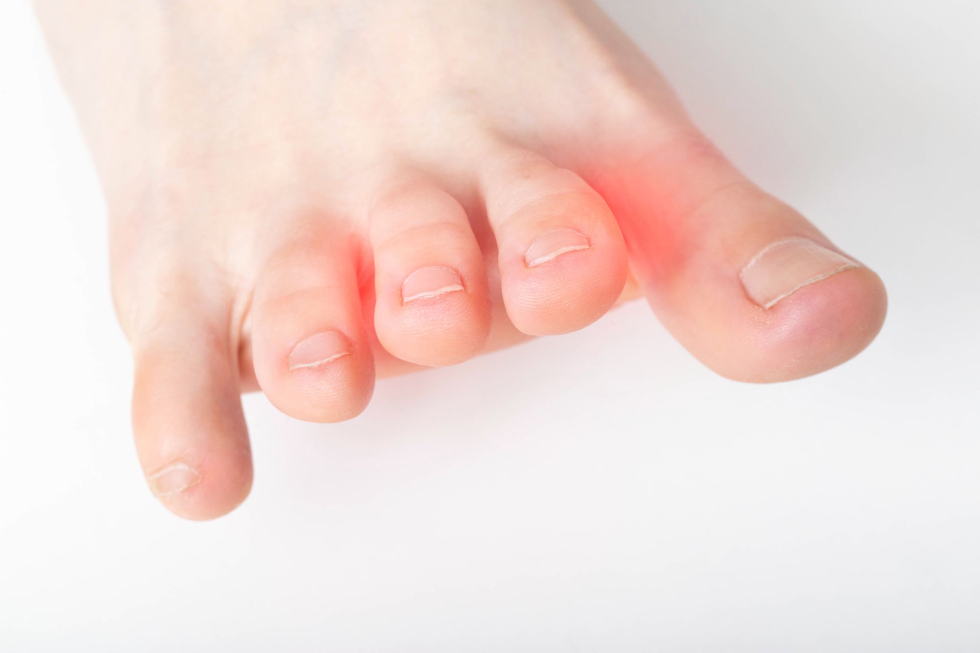 Foot with red highlights indicating pain around the middle toes.