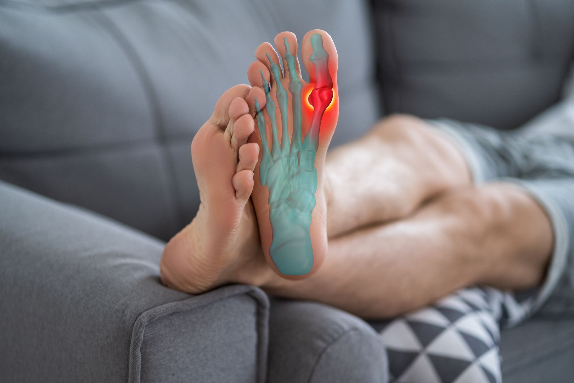 Foot resting on a gray sofa, highlighted red area on the big toe, indicating pain; blue on the sole.