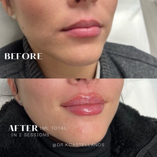 A before and after picture of a woman 's face