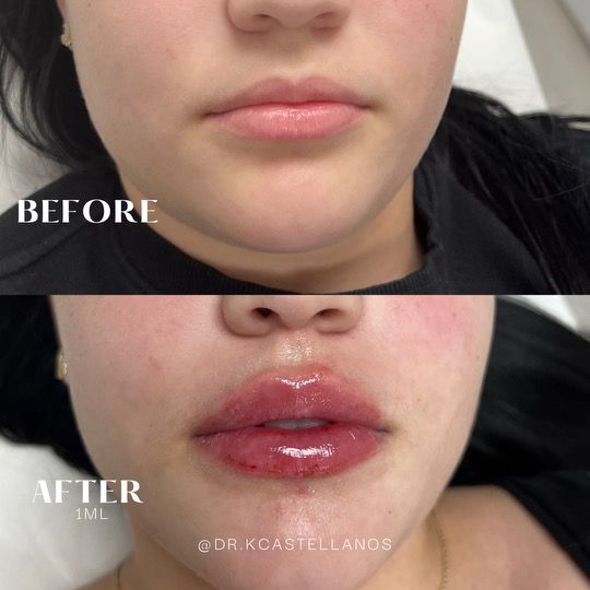 A before and after picture of a woman 's face