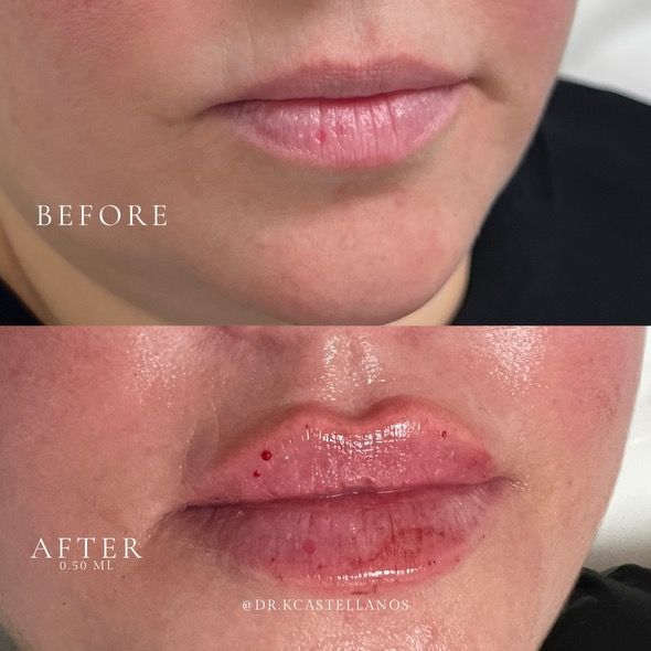 A before and after photo of a woman 's face