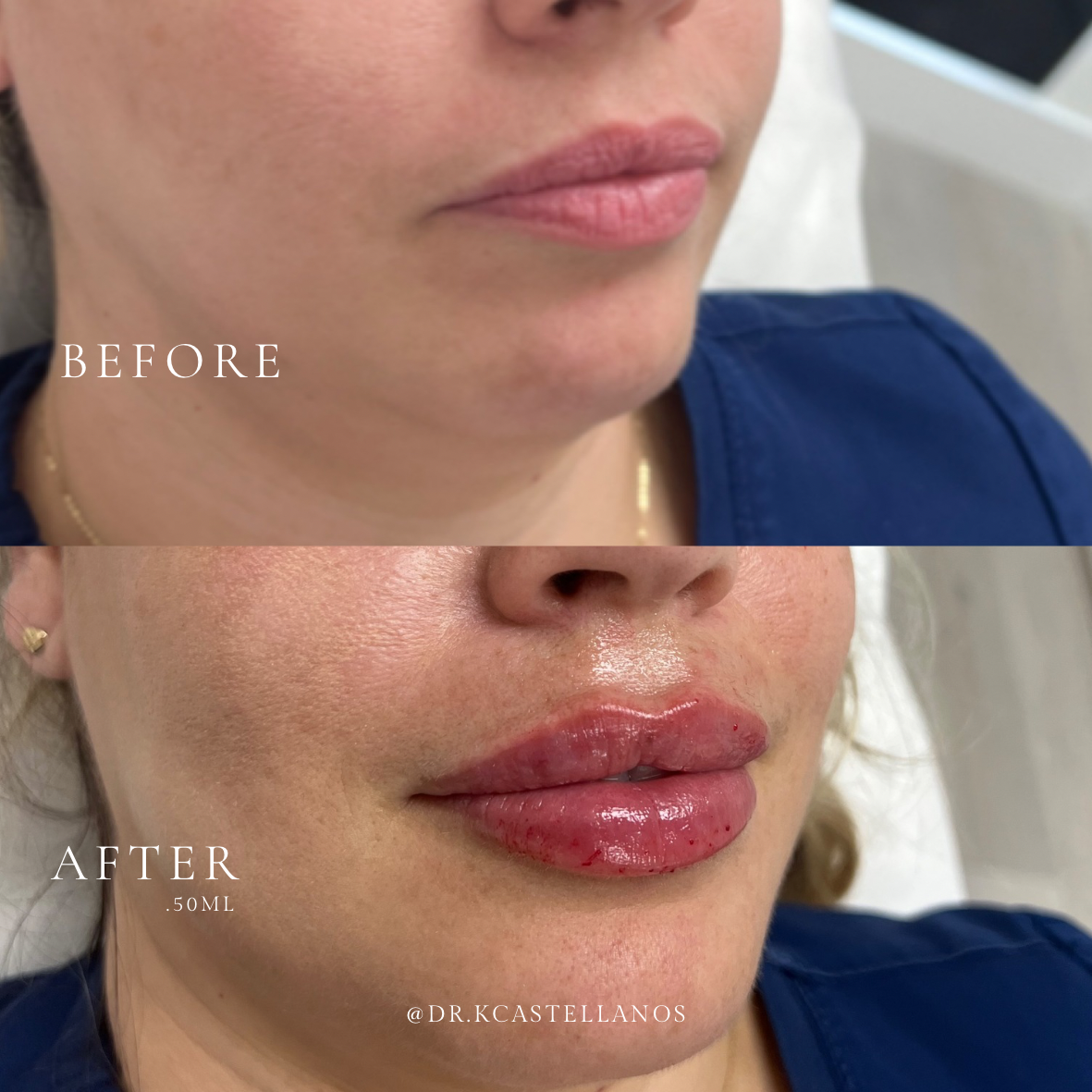 A before and after photo of a woman 's face