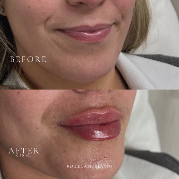 A before and after photo of a woman 's face