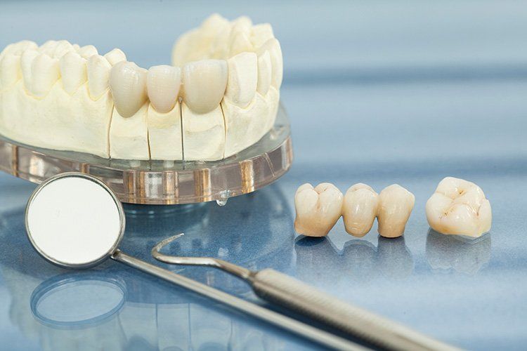 A model of teeth , dental instruments , and dental crowns on a table.