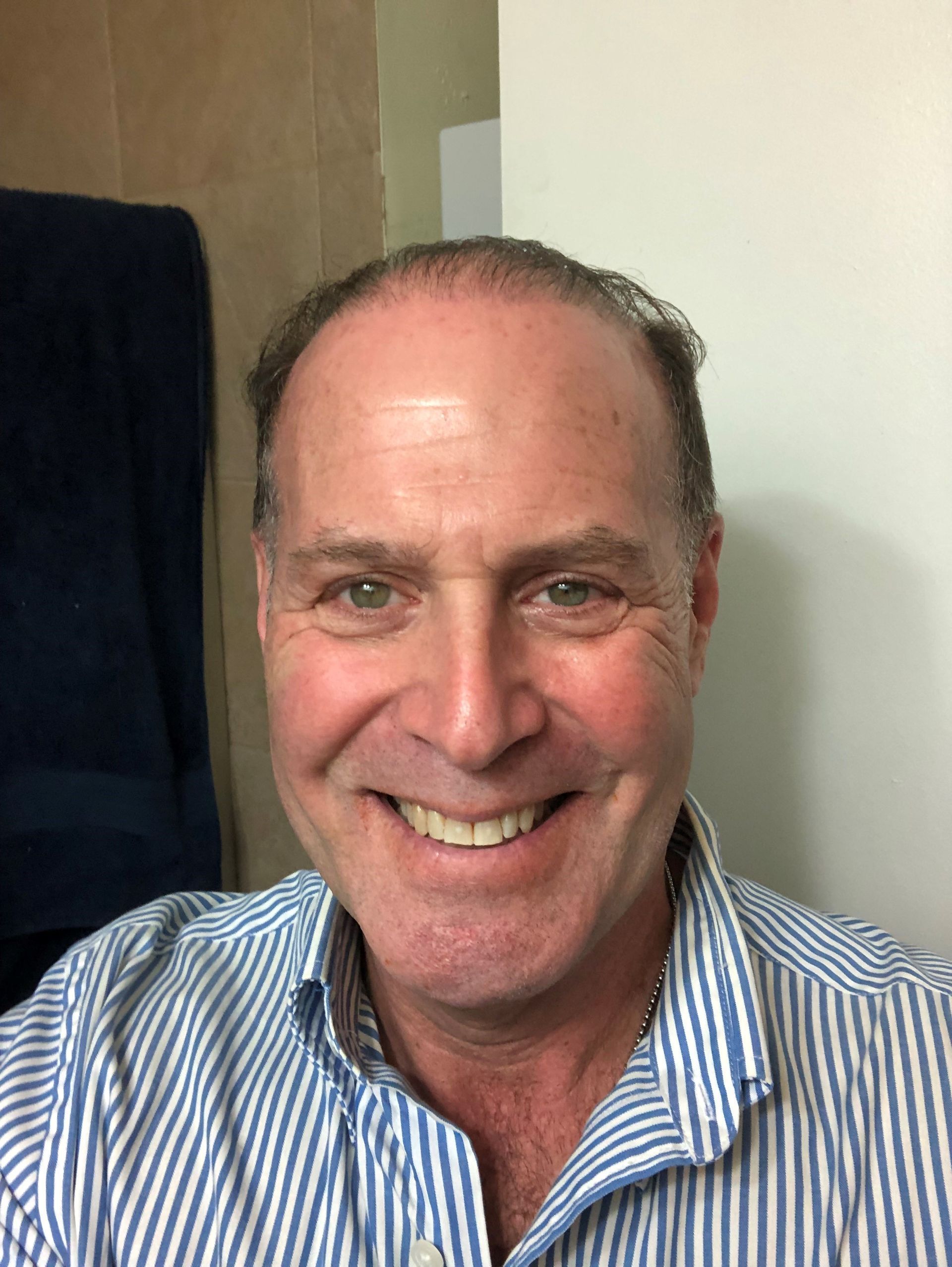 A man wearing a blue and white striped shirt is smiling for the camera.