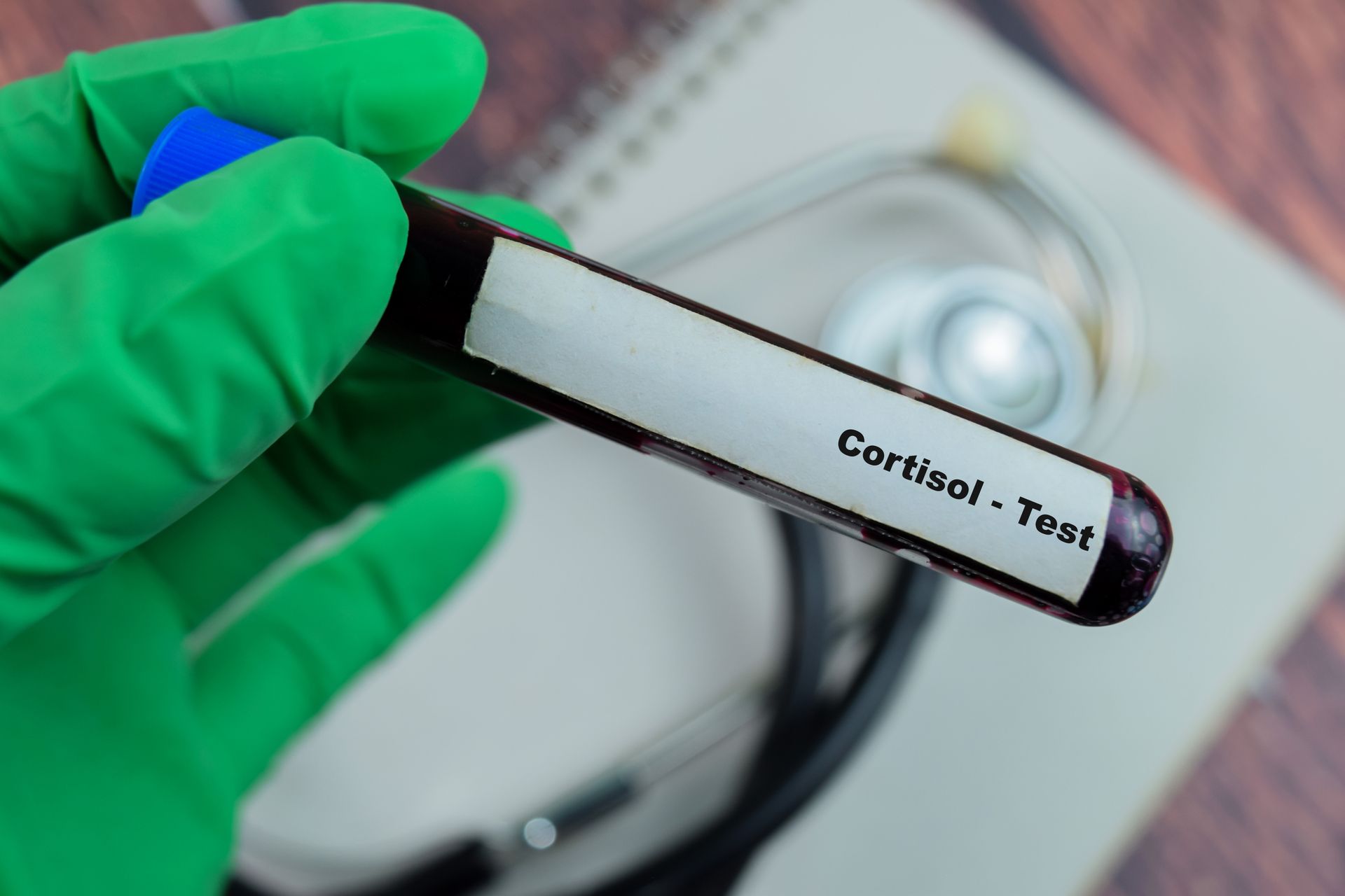 a hand in a green glove is holding a test tube labeled cortisol test