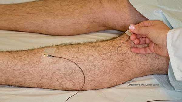 UNIDAD DE ELECTRODIAGNÓSTICO BC