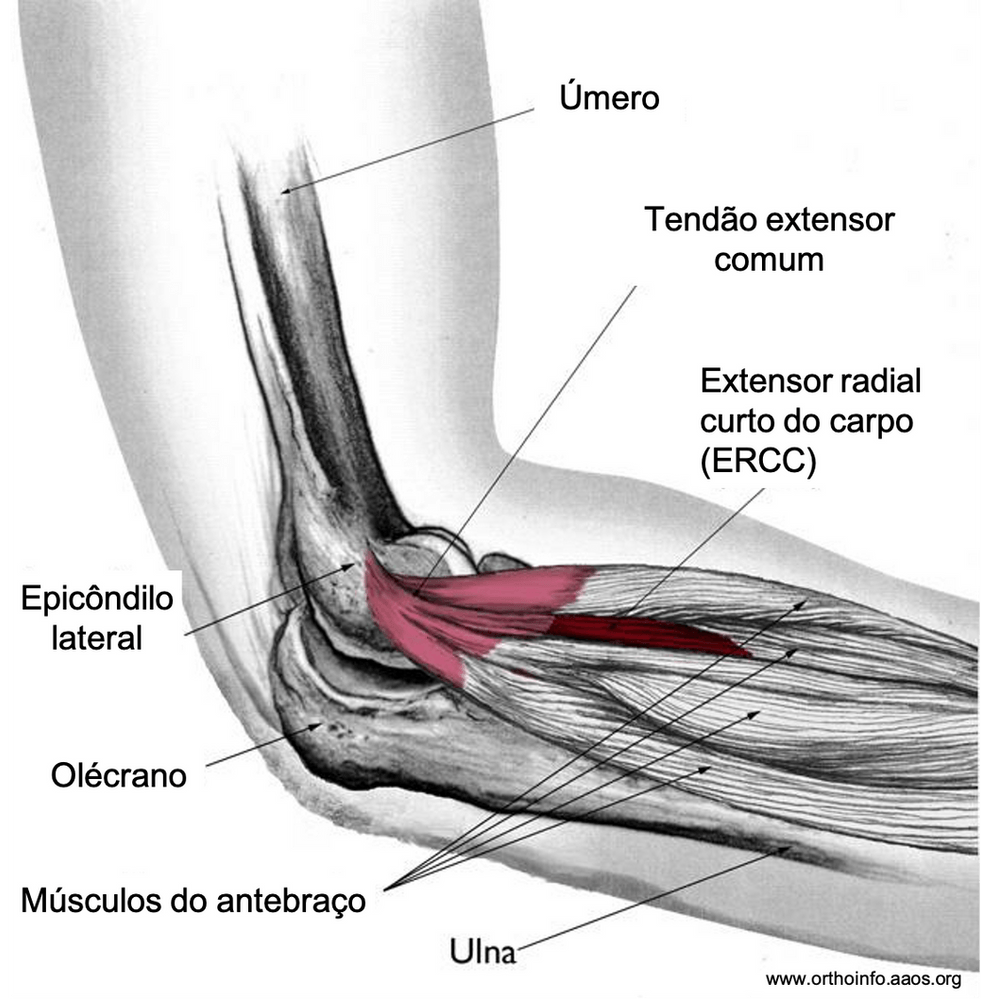 Anatomia da face lateral do cotovelo - epicondilite lateral ('tennis elbow')