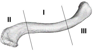 Classificação de Allman para a fraturas da clavícula - as fraturas do terço médio (tipo I) representam 80% dos casos.
