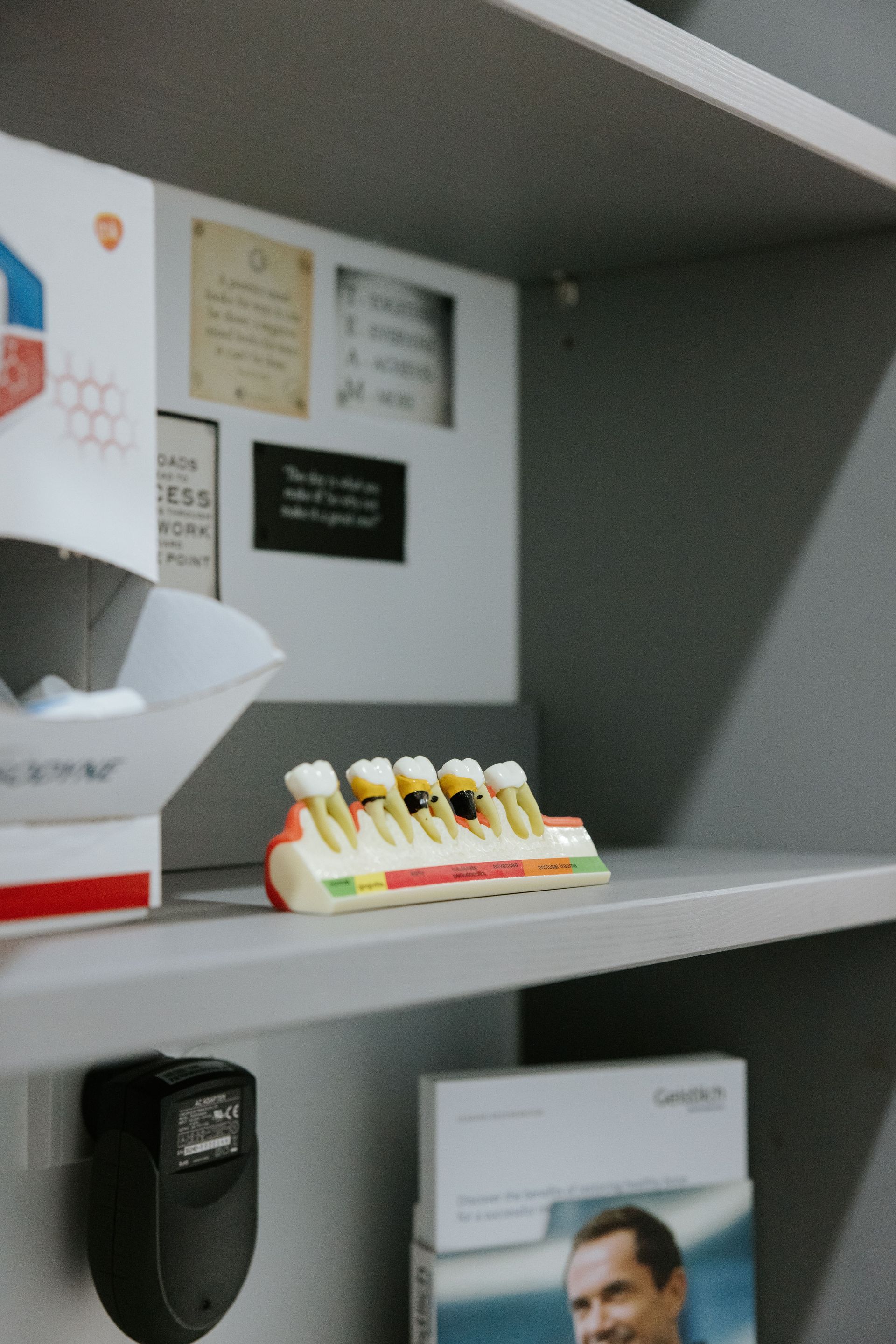 Model of teeth with cavities on a shelf in a dental office. — McDonald Dental in Gympie, QLD