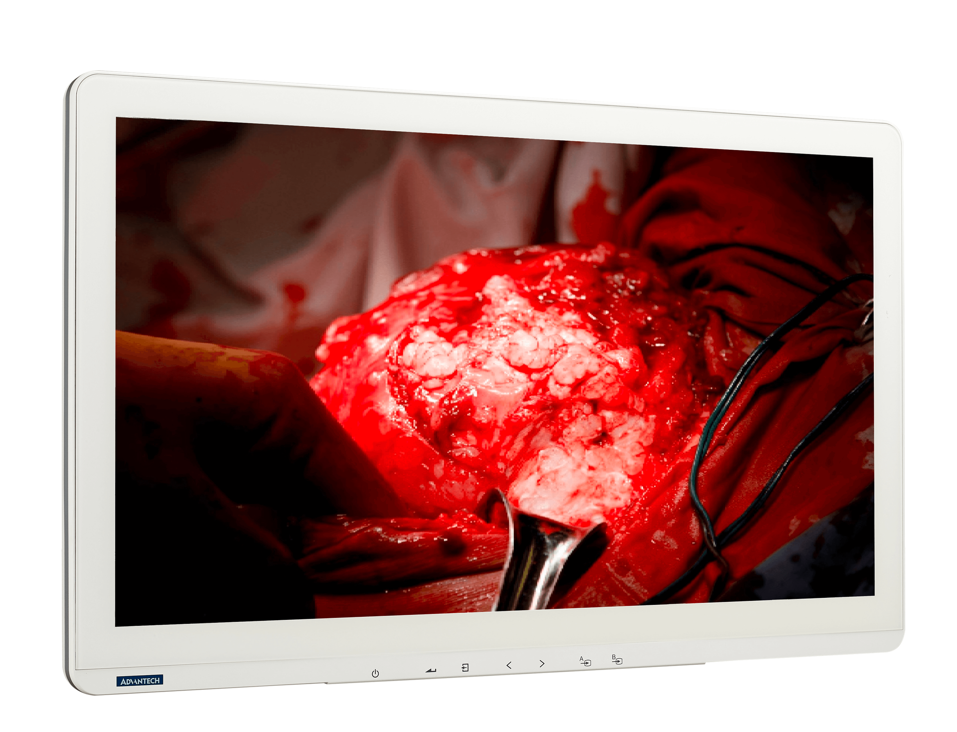 Advantech's PAX-332 surgical monitor