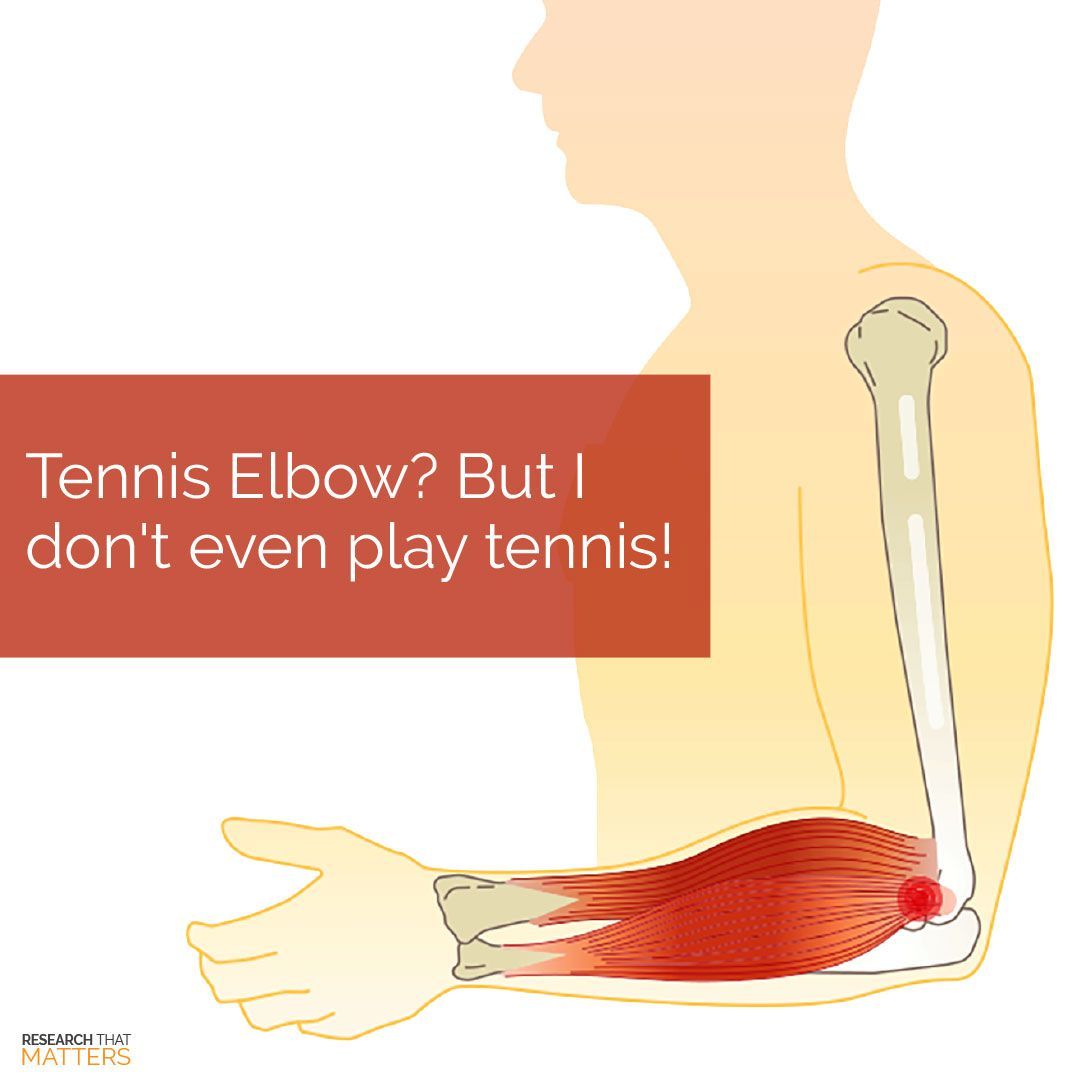 (JUL) Week 4 - Tennis Elbow - But I Dont Even Play Tennis.jpg