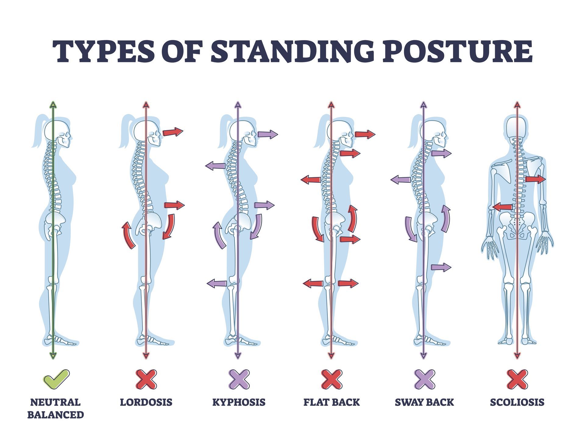 a poster showing the different types of standing posture .