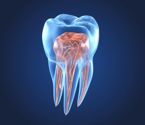 Intervento di endodonzia