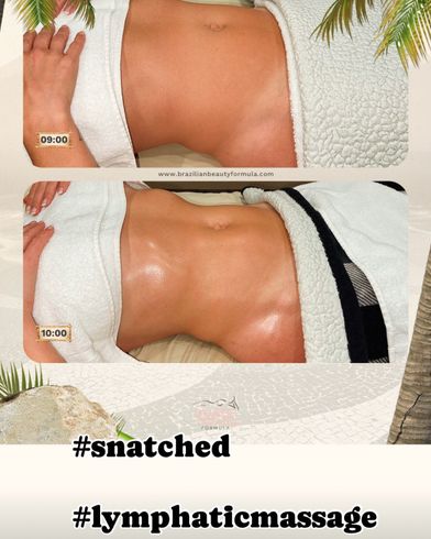 A woman 's stomach is shown before and after a lymphatic massage.