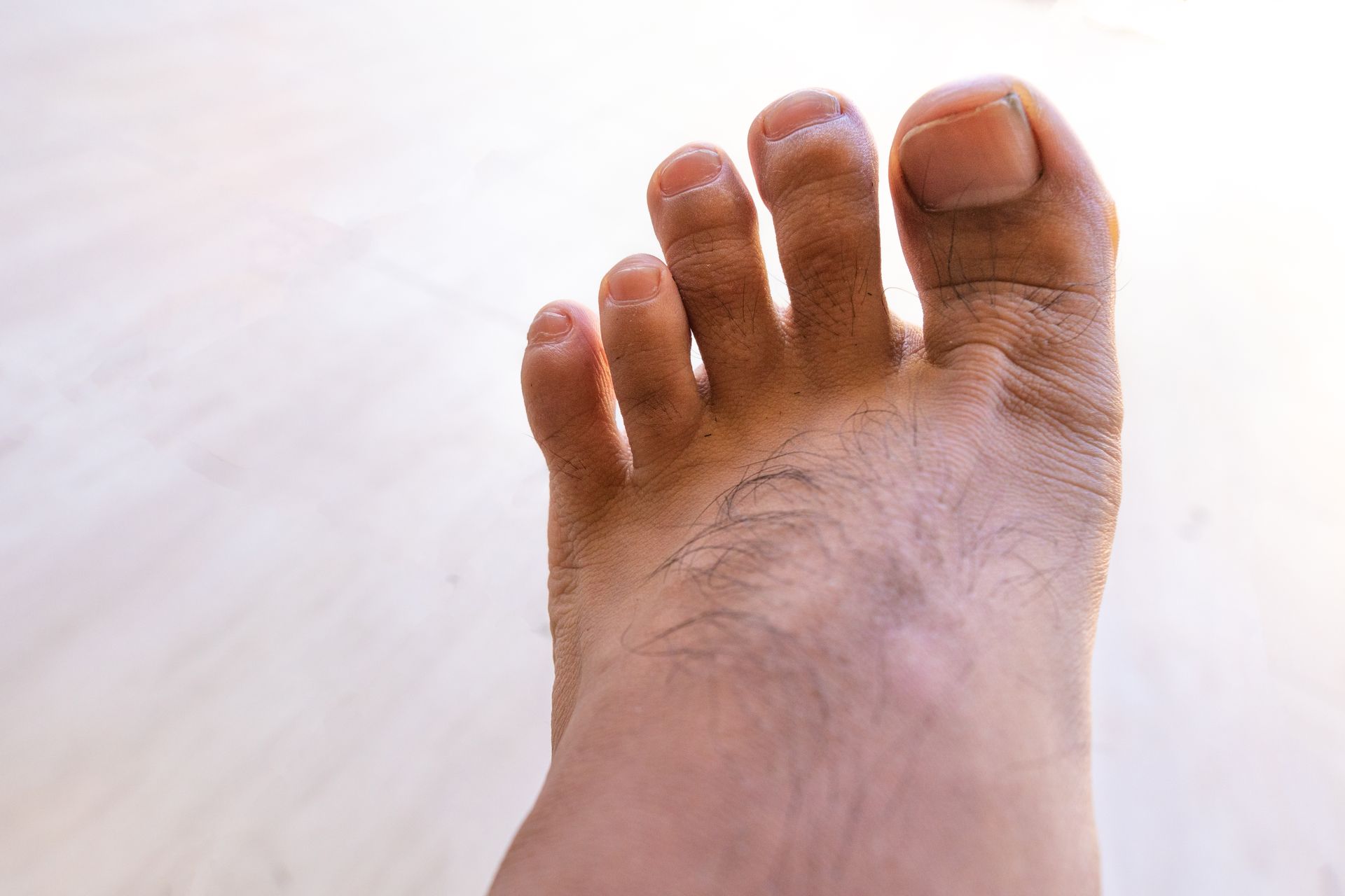 Close-up of a human foot with five toes, visible skin, and some hair against a light background.