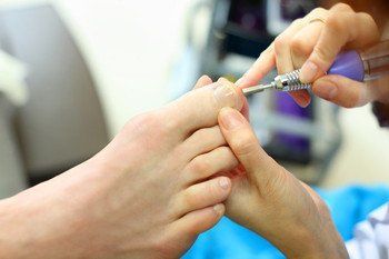 A toenail problem being treated