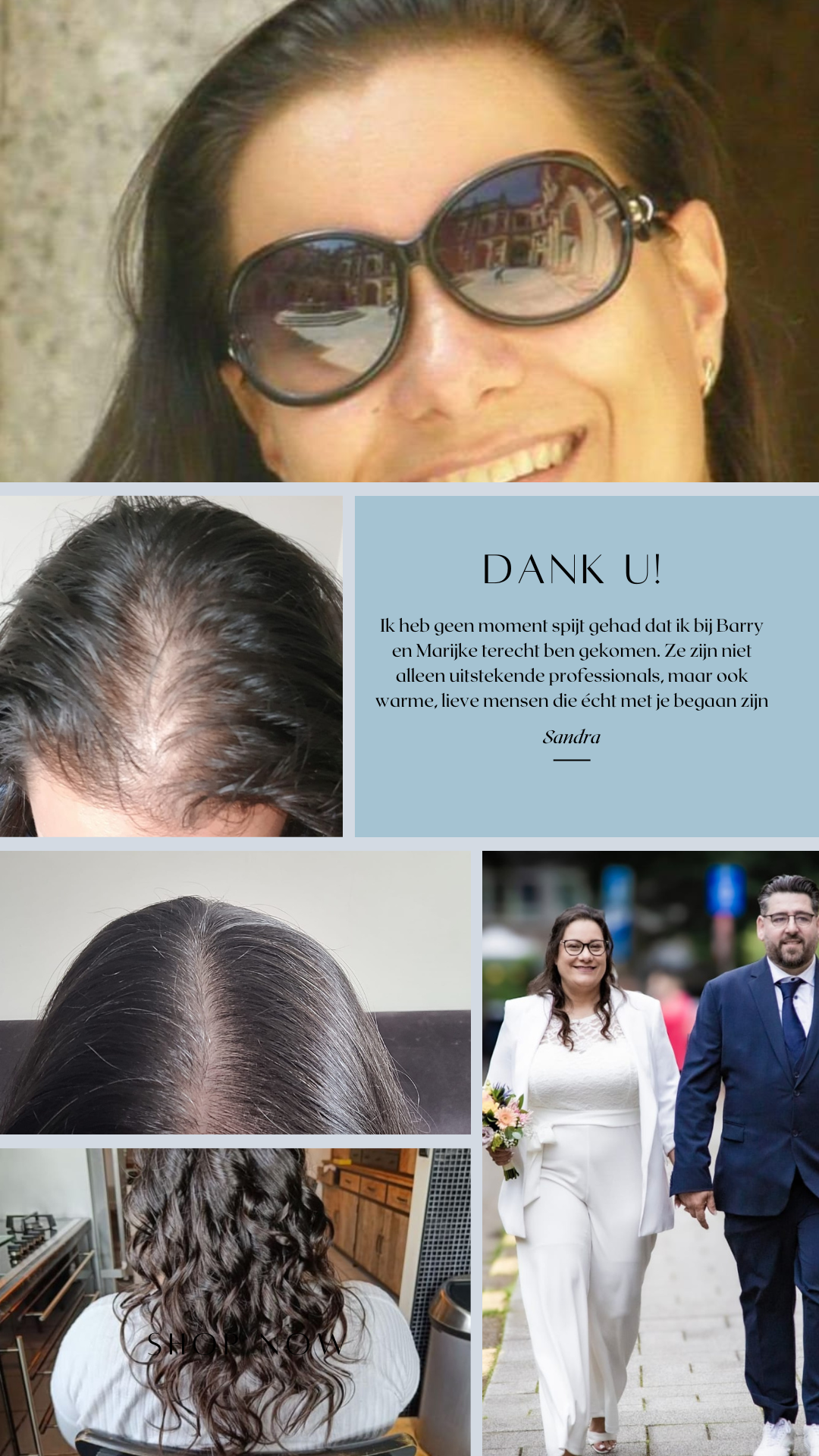 Sandra getuigt over haar transformatie in de Haar en Huid Kliniek in Tessenderlo