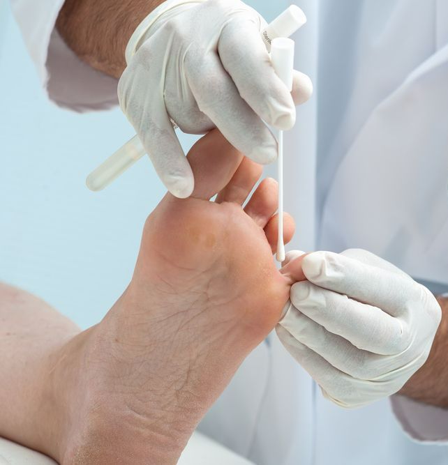 A Doctor is Examining a Patient's Foot With Gloves on — Newcastle Foot & Ankle Clinic Charlestown In Charlestown, NSW