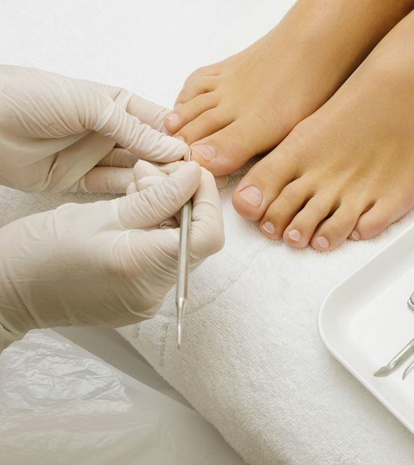 A Person Wearing White Gloves is Working on a Woman's Feet — Newcastle Foot & Ankle Clinic Charlestown In Charlestown, NSW