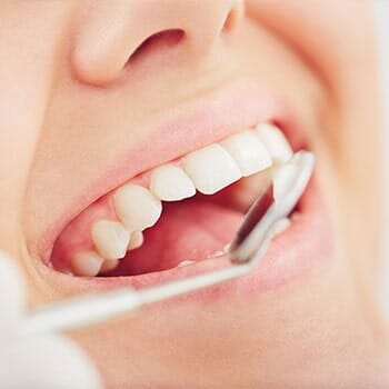 White teeth — general dentistry in Biloxi, MS