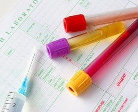 Medical specimens - Drug testing services in Little Falls, MN