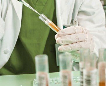 Urine test - Social services in Little Falls, MN