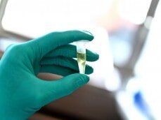 Specimen on test tube - Drug test in Little Falls, MN Specimen on test tube - Drug test in Little Falls, MN