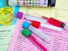 Blood and urine samples - Drug test in Little Falls, MN Blood and urine samples - Drug test in Little Falls, MN