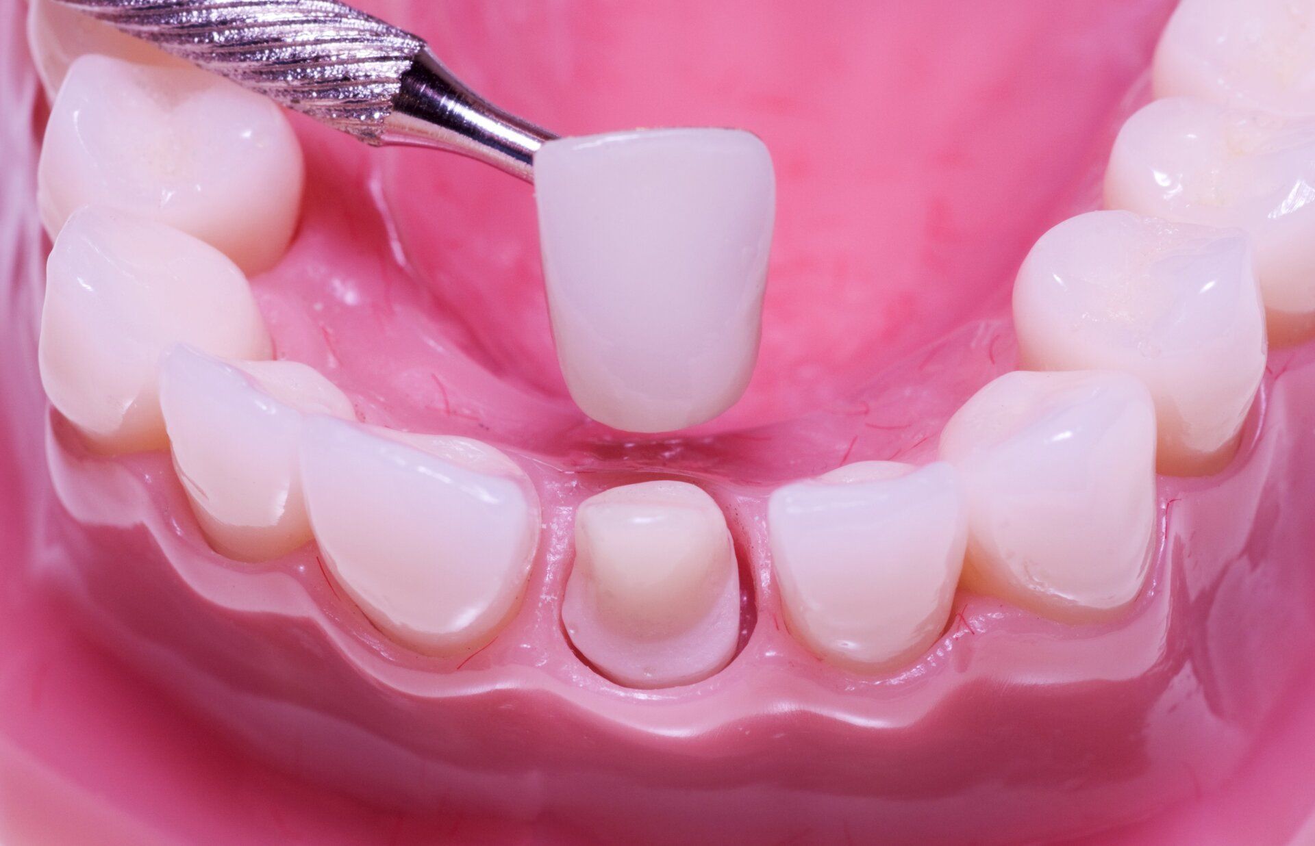 toothfairy dental vrgas toothfairy dental vrgas