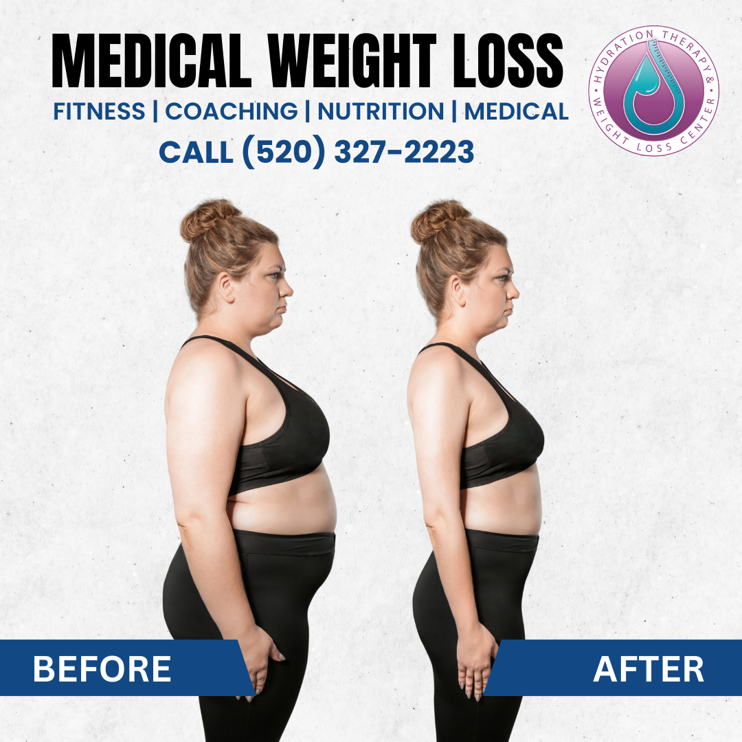 Medical weight loss advertisement: side-by-side woman photos, before and after weight loss.