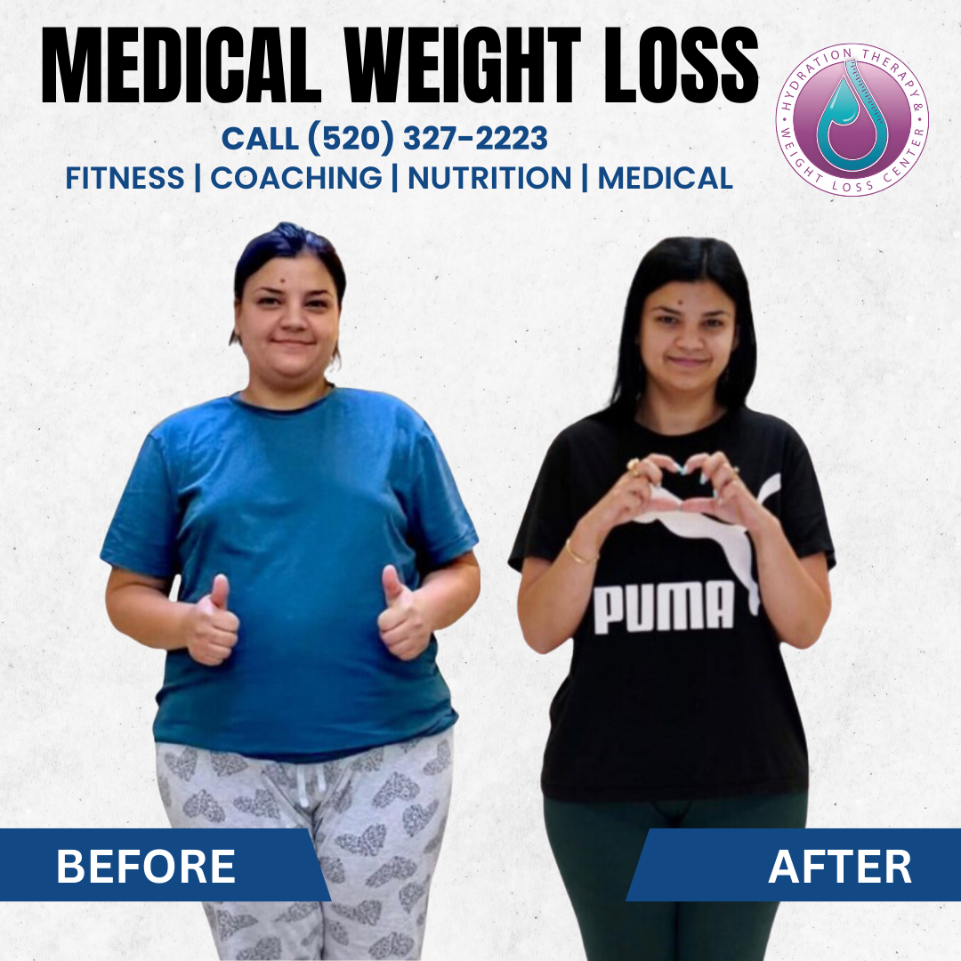 Weight loss advertisement. Woman before and after weight loss. Text: Medical weight loss, call (520) 327-2223.