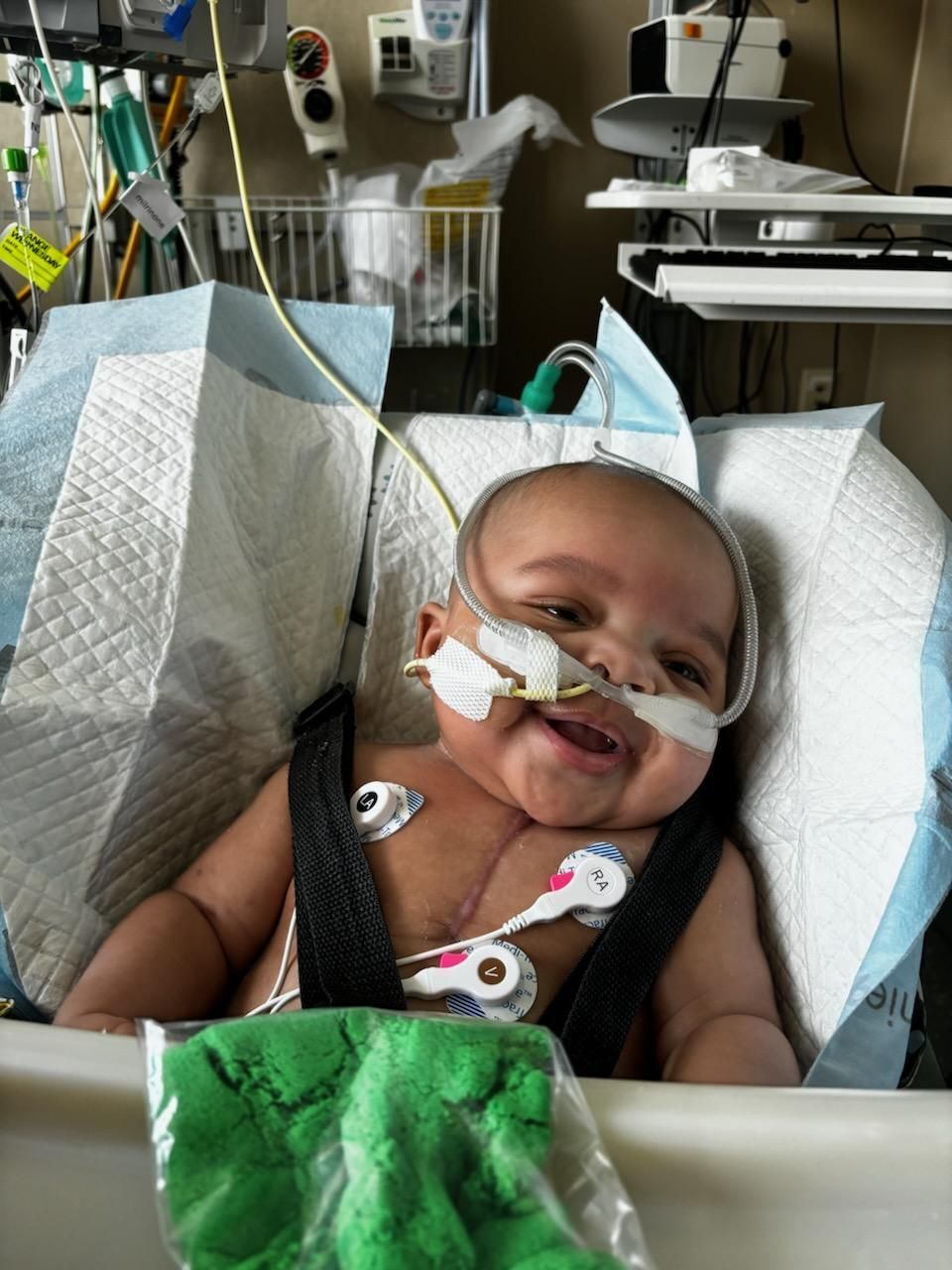Khy'Von, baby who had a heart transplant.